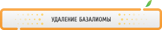 лечение базалиом